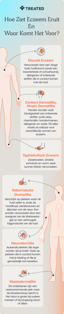 NL_How can eczema look__M
